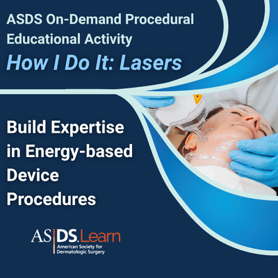 How I Do It Lasers Banner Ad